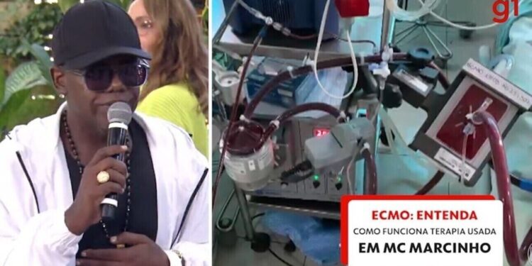 MC Marcinho usa terapia conhecida como ECMO, espécie de pulmão artificial; entenda como funciona